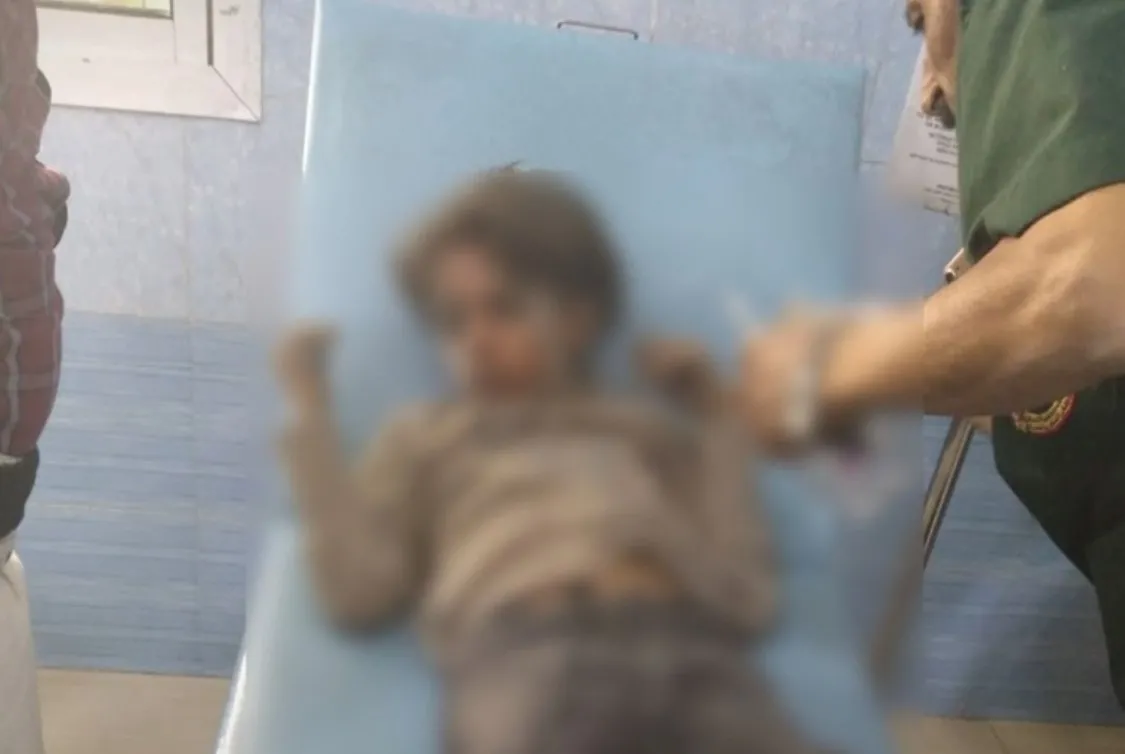  تعز.. إصابة طفلين بقصف حوثي تزامن مع زيارة فريق أممي رفيع